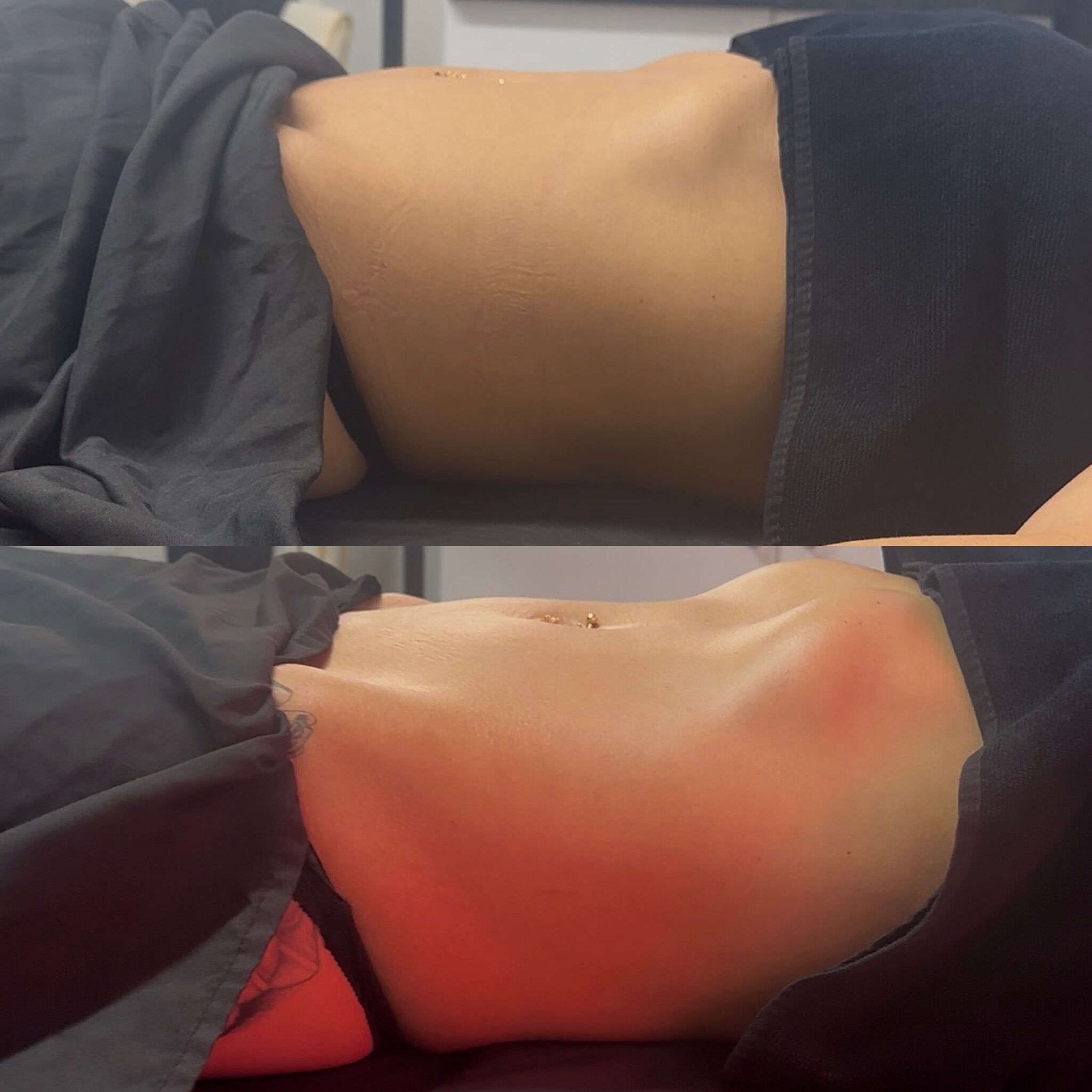 Before & after – lymphatic drainage